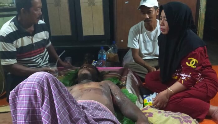 Sepeda Motor Ditabrak, Tubuh Pedagang Bakso Melepuh Tersiram Air Mendidih