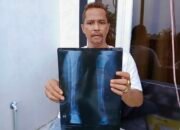 Status Penahanan Tersangka Pembacokan Dialihkan, Korban: Hukum Bisa Dibeli?